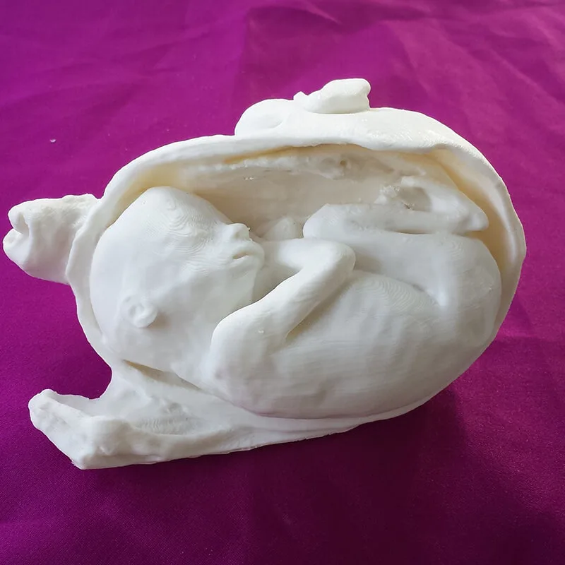 mundo-real-al-3d-regalo-unico_feto-utero